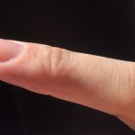 指第一関節の痛み！後遺症を残さないために知っておくべき６つの原因