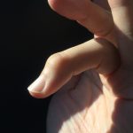 突き指で第一関節が伸びない！ – マレットフィンガーによる指の変形と治療法
