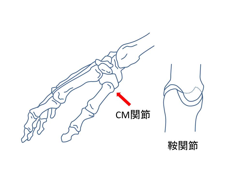 CM関節の構造図