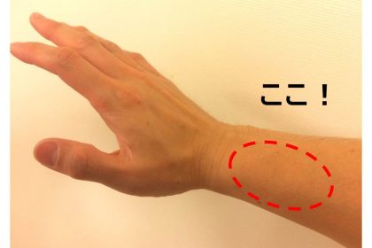 インターセクションシンドロームが起きる位置（写真）