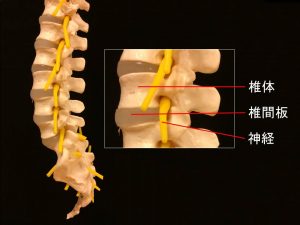 脊柱管狭窄症