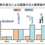 長く歩けない高齢者の腰痛！脊柱管狭窄症について（１）