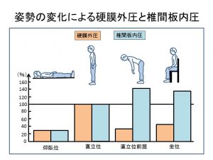 姿勢の変化による硬膜外圧と椎間板内圧の変化