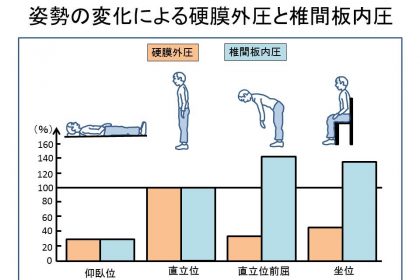 姿勢の変化による硬膜外圧と椎間板