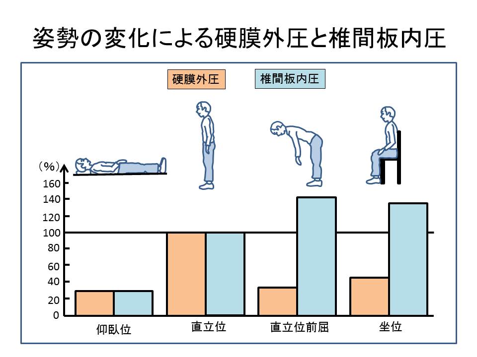 姿勢の変化による硬膜外圧と椎間板