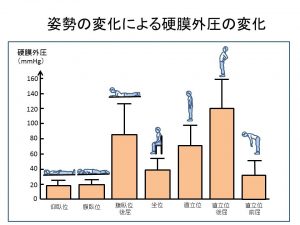 姿勢の変化による硬膜外圧の変化