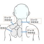 マッサージでは「肩こり」が治らない理由とその解消法（２）