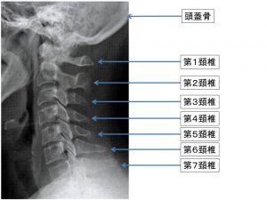 頚椎の写真