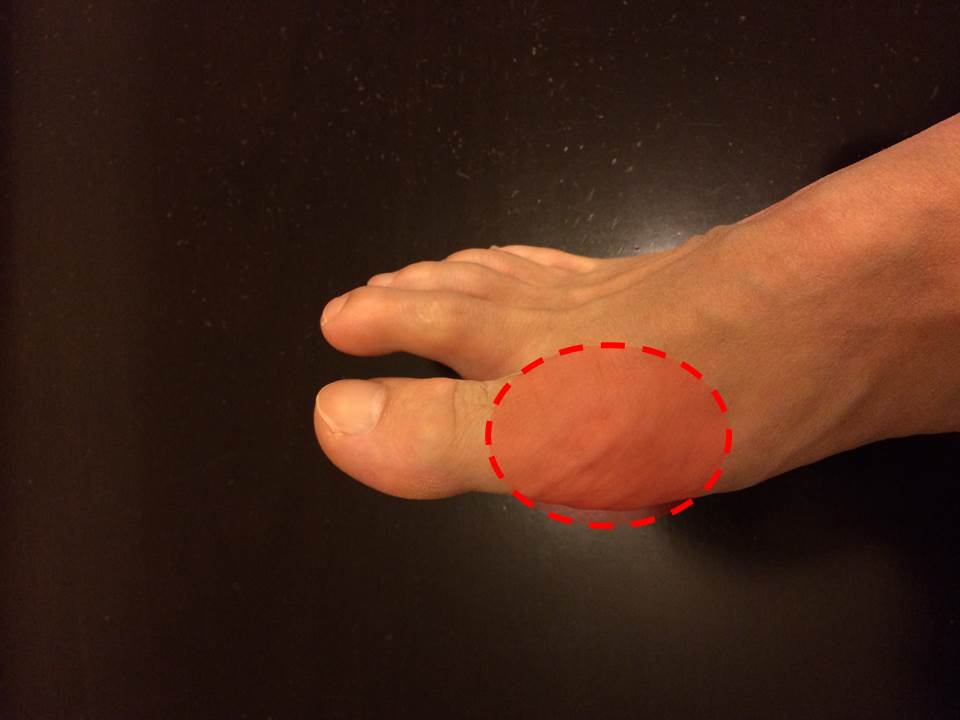 状態別の症状と治療法