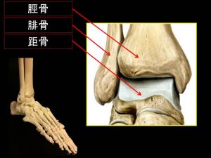 前距腓靭帯損傷