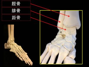 前距腓靭帯損傷