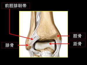 前脛腓靭帯損傷 (2)