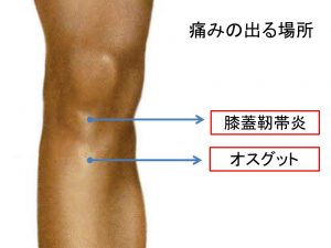 オスグット(4)