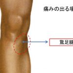 鵞足腱炎