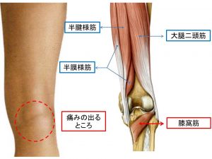 膝窩筋