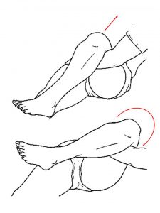 大腿骨頭すべり症