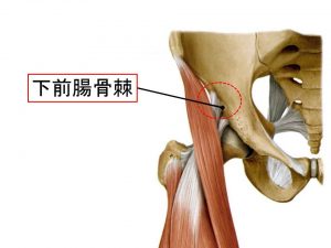 下前腸骨棘の裂離骨折 (4)