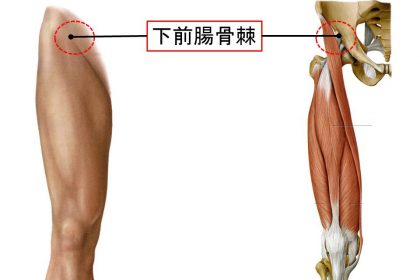 下前腸骨棘の裂離骨折 (1)