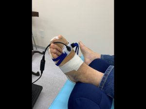 足の趾の骨折の治療風景